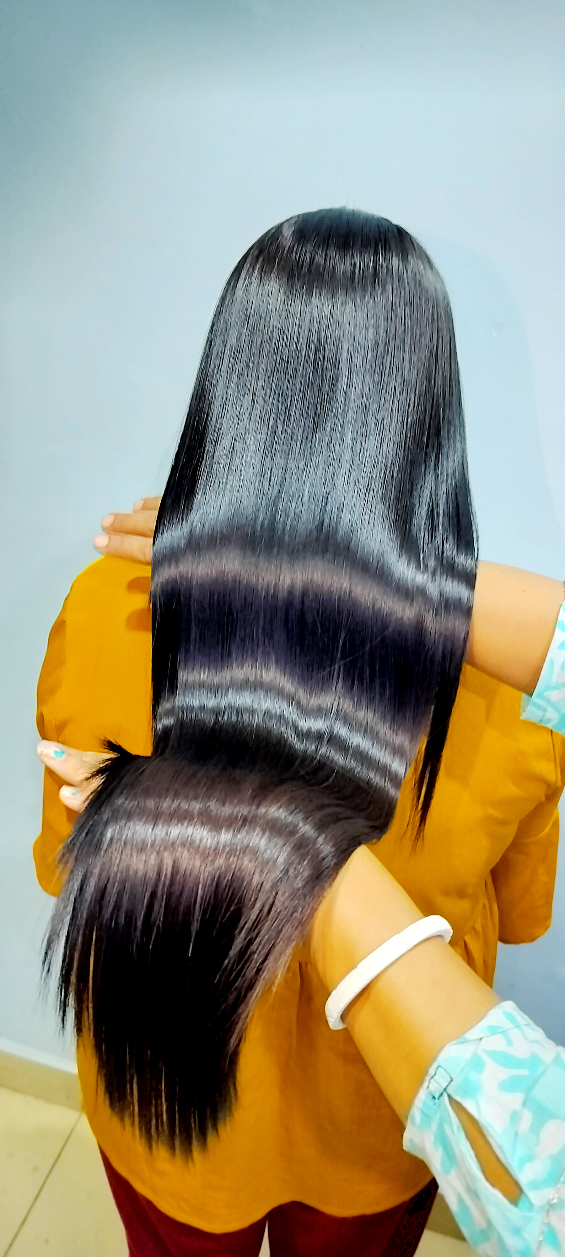 Botoxsmooth Treatment